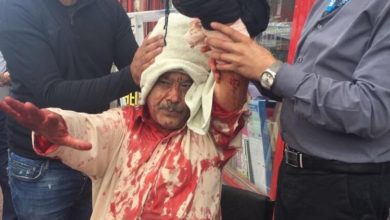 UK; Manchester shopkeeper Saeed Ahmed attacked with machete