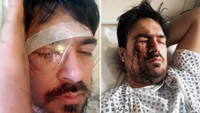 Birmingham; Taxi driver Afaq Ifikhar loses eye after being hit by drunk passenger Birmingham; Taxi driver Afaq Ifikhar loses eye after being hit by drunk passenger