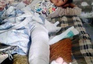 Bewal; Six year old daughter of Fakhar Shah injured by hit and run motorcyclist in Morra Jandi