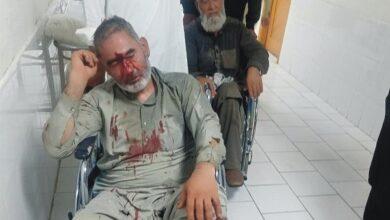 Kahuta: Four people injured due to the firing of Sardar Muhammad Hussain’s colleagues
