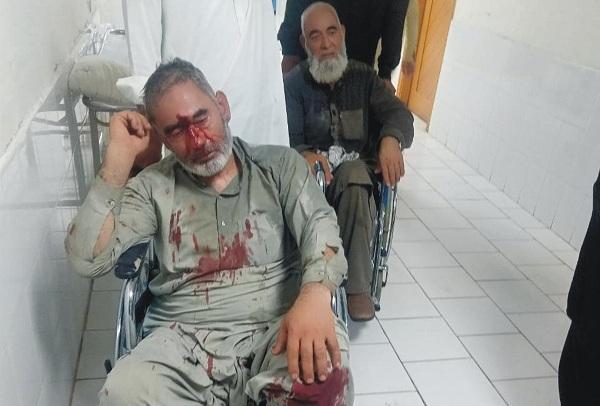 Kahuta: Four people injured due to the firing of Sardar Muhammad Hussain’s colleagues