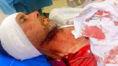 Kahuta: Robbery Incident at General Store Near Karachi School in Kahuta, Owner shot and injured