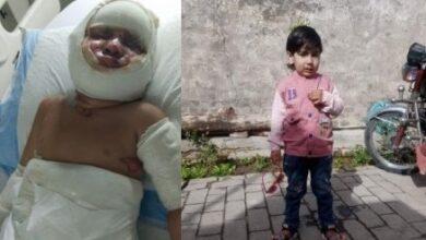 Gujar Khan, Naralai: Eid Joy Turns to Mourning as Burned Children Succumb After Gas Leak Tragedy