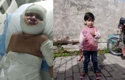 Gujar Khan, Naralai: Eid Joy Turns to Mourning as Burned Children Succumb After Gas Leak Tragedy